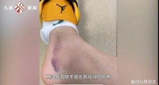 广东东莞，一女子溜冰时被男子推倒后，应当由谁来承担责任
